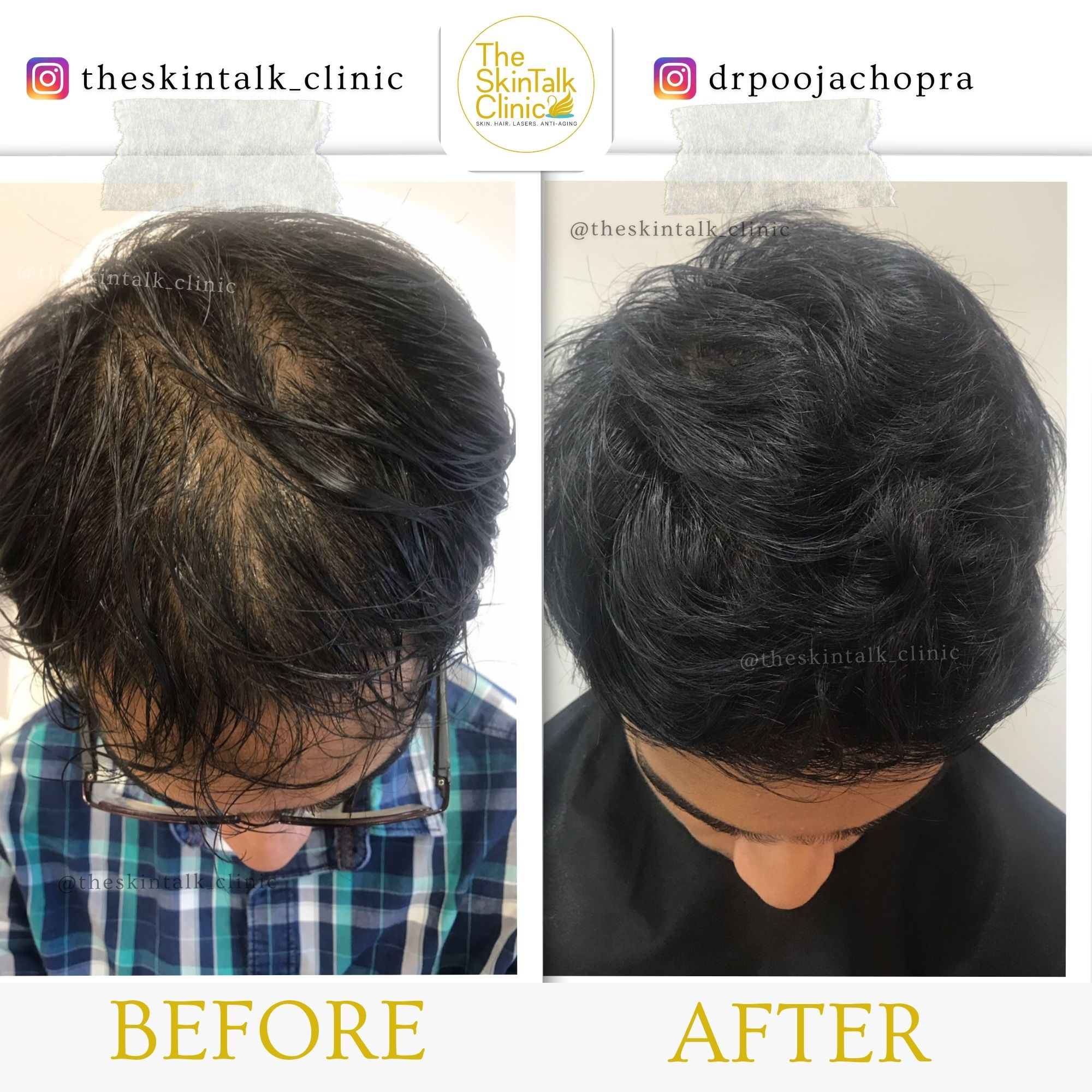 Hair Treatment
