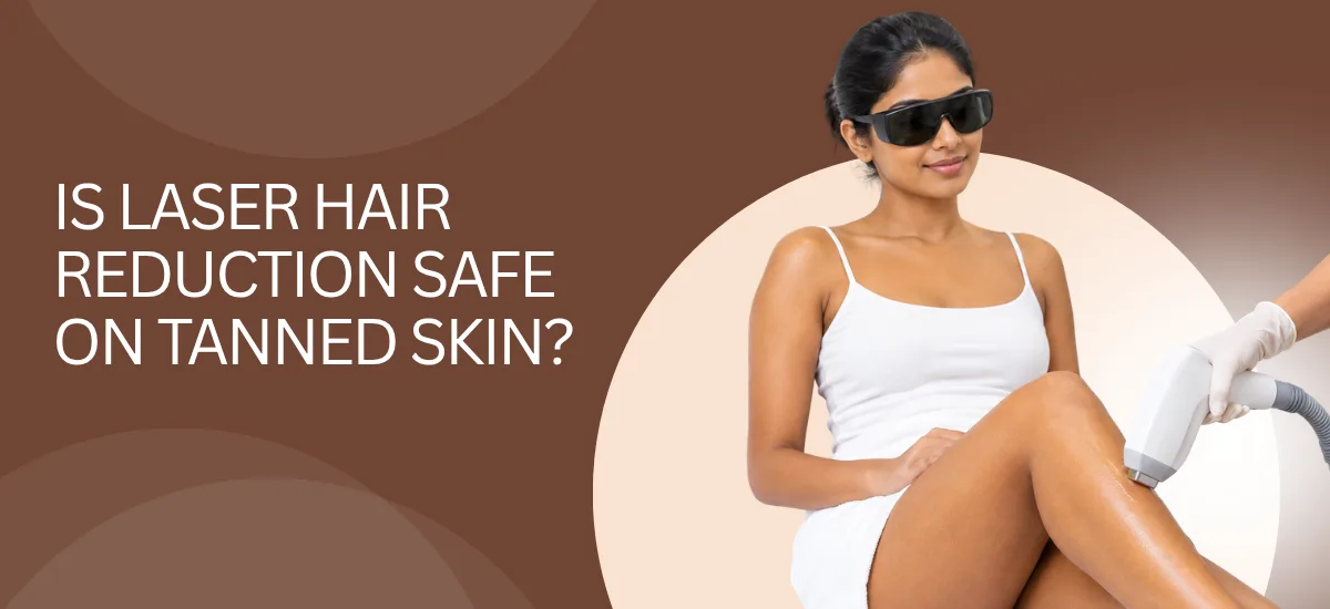 Is Laser Hair Reduction Safe on Tanned Skin?